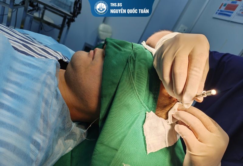 Cấy tóc hói đỉnh đầu có đau không