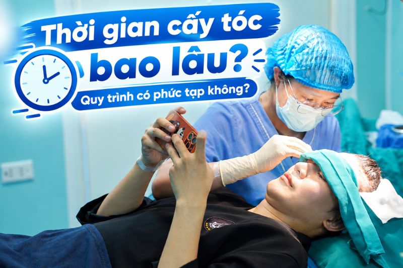 cấy tóc mấy bao lâu
