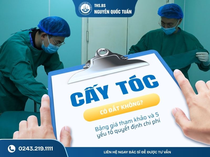 cấy tóc có đắt không
