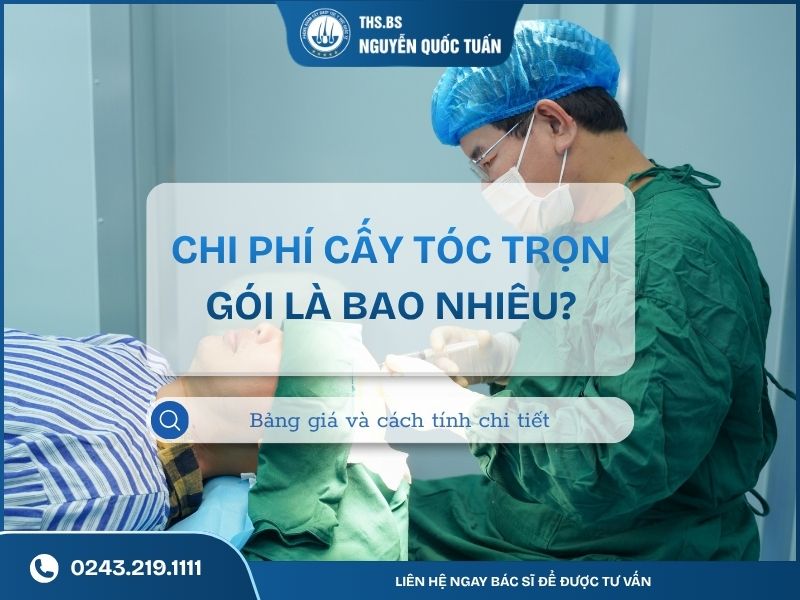 chi phí cấy tóc trọn gói là bao nhiêu
