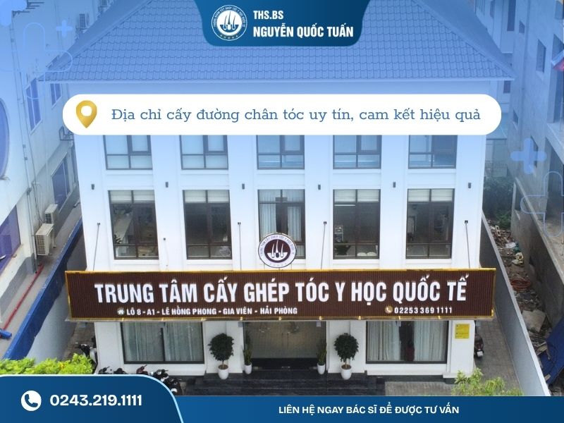 Địa chỉ cấy đường chân tóc uy tín, cam kết hiệu quả