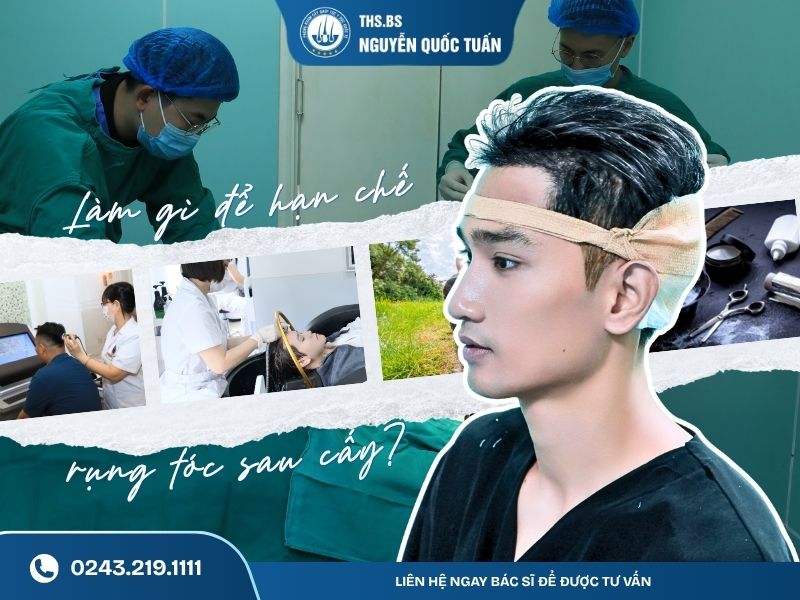 Làm gì để hạn chế rụng tóc sau cấy 
