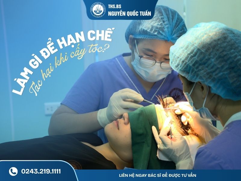 Làm gì để hạn chế tác hại khi cấy tóc 