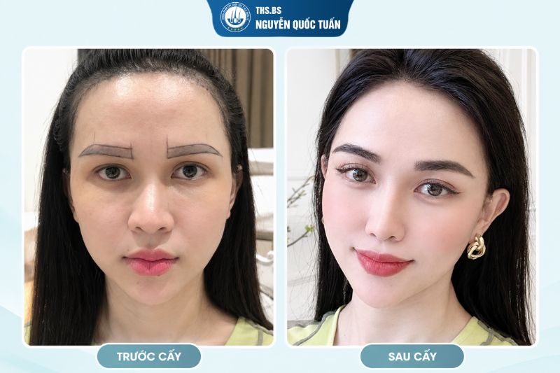  Bao lâu lông mày mọc dài đẹp 