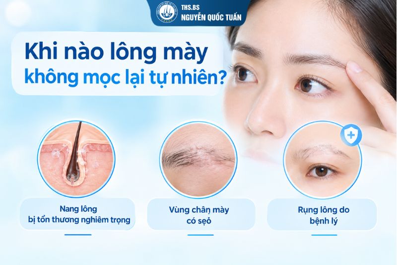 Khi nào lông mày không mọc lại tự nhiên  