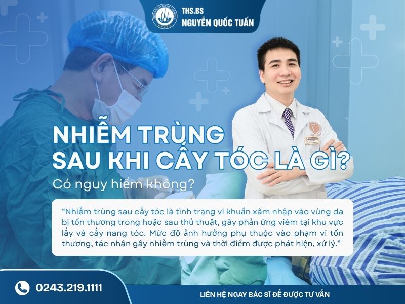 Nhiễm trùng sau khi cấy tóc là gì? Có nguy hiểm không 
