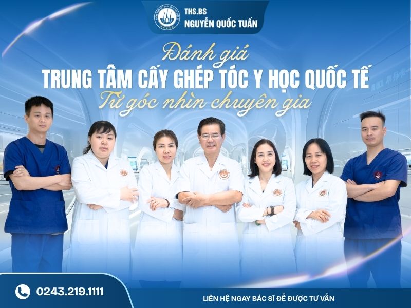 đánh giá trung tâm cấy tóc