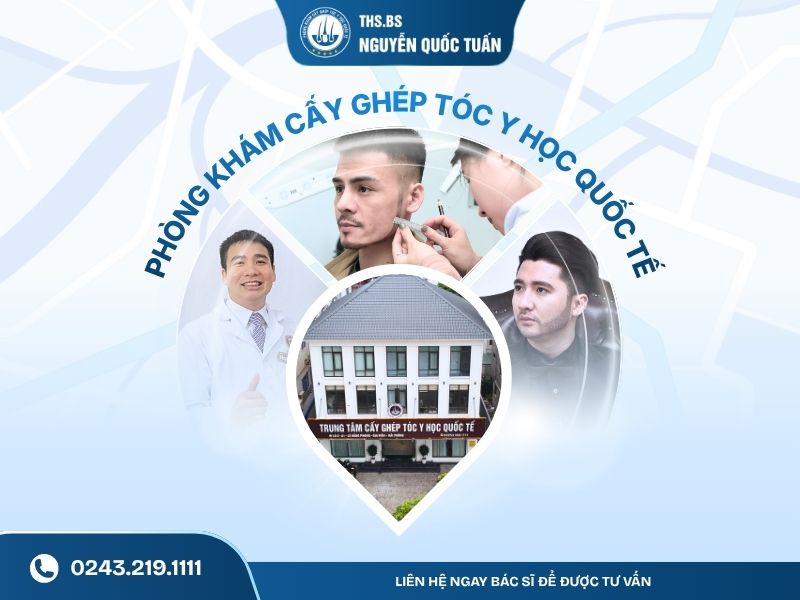 Cơ sở cấy râu uy tín hiện nay 