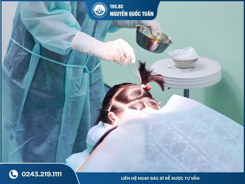 Quá trình lấy nang và cấy tóc  
