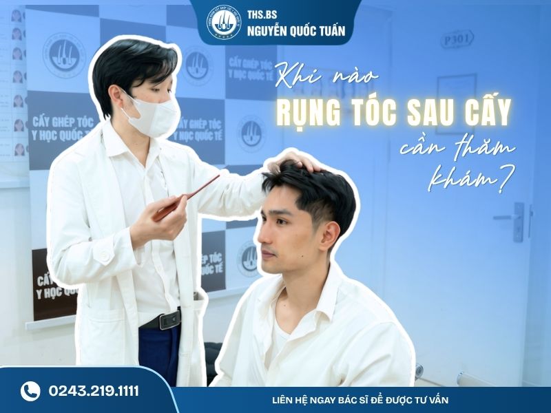 Khi nào rụng tóc sau cấy cần thăm khám 