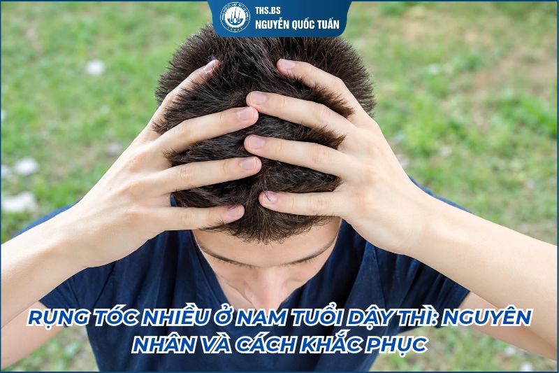 rung tóc nhiều ở nam tuổi dậy thì