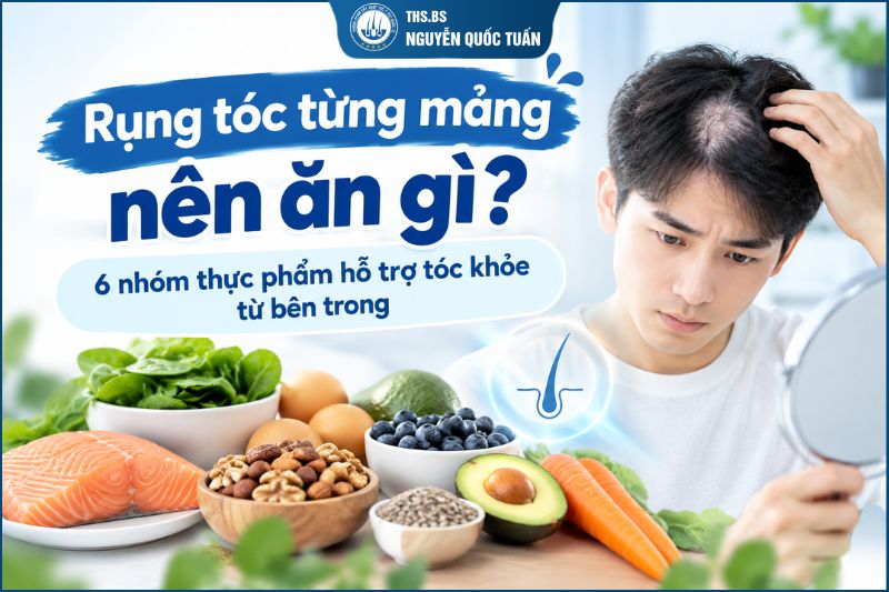 rụng tóc từng mảng nên ăn gì