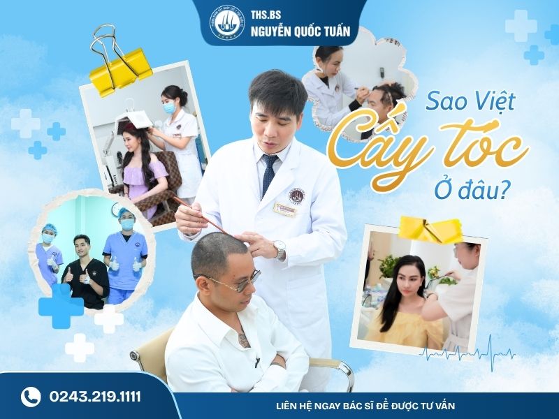 sao viết cấy tóc