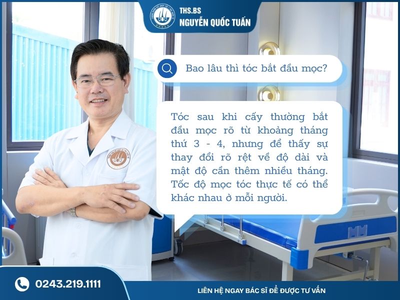 Sau khi cấy tóc bao lâu thì tóc bắt đầu mọc 