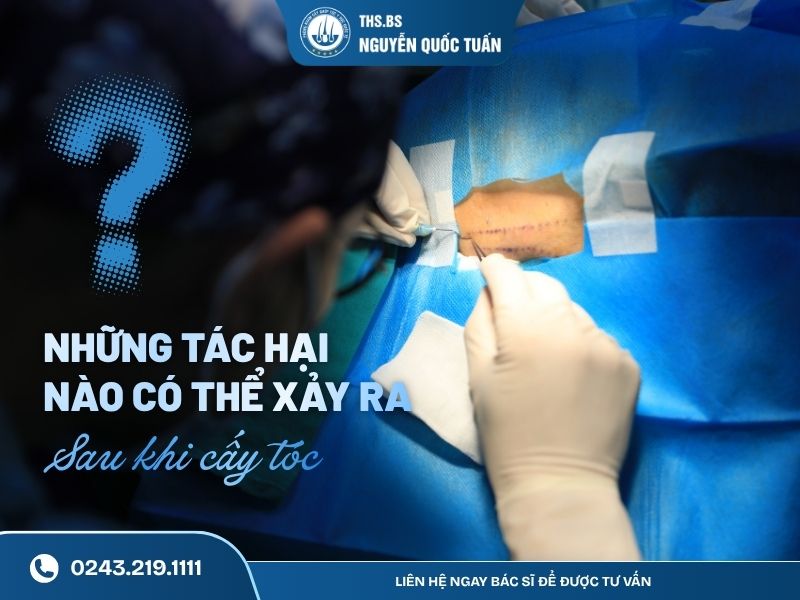 6 tác hại có thể xảy ra sau khi cấy tóc nếu thực hiện sai cách 