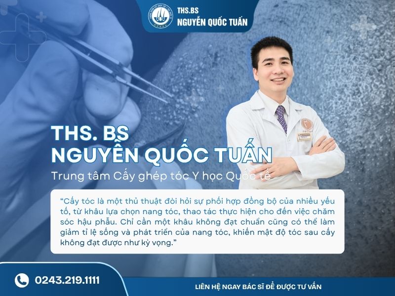 Tại sao cấy tóc lại thất bại?