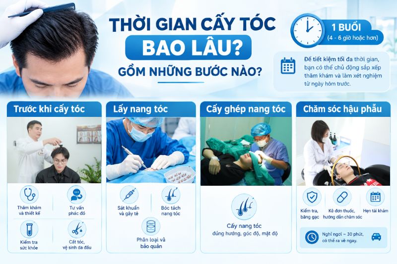 Thời gian cấy tóc trong bao lâu? Gồm những bước nào  