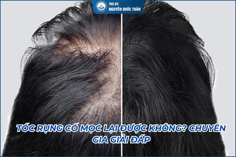 tóc rụng có mọc lại được không