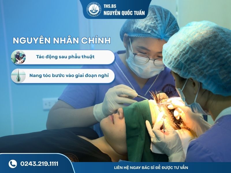 Nguyên nhân tóc sau cấy bị rụng  