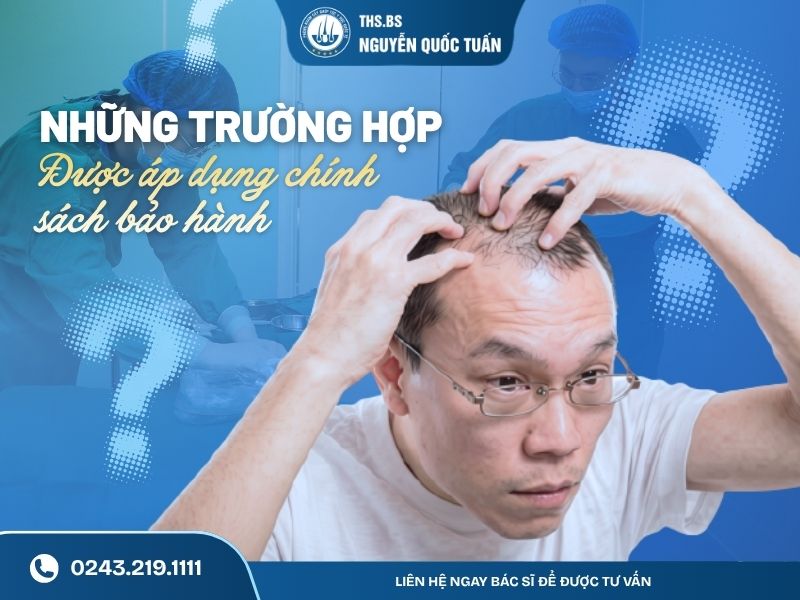 Những trường hợp nào có thể được áp dụng chính sách bảo hành 