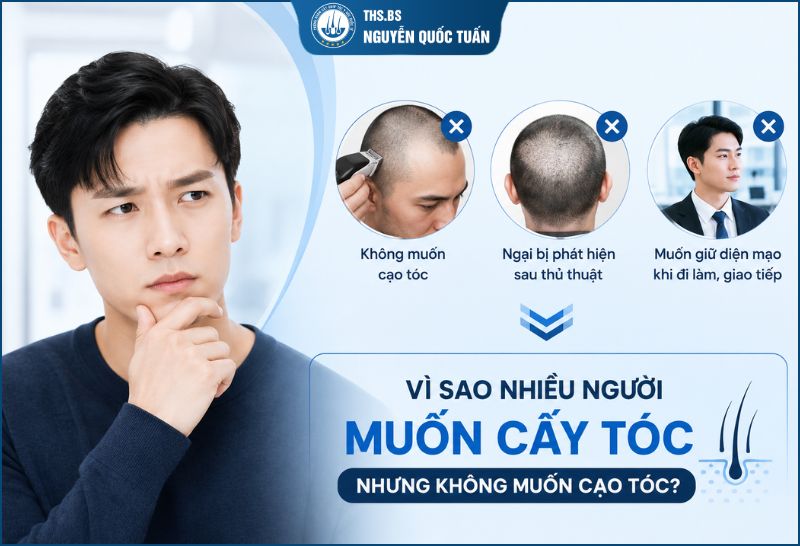 Vì sao nhiều người muốn cấy tóc nhưng không muốn cạo tóc 