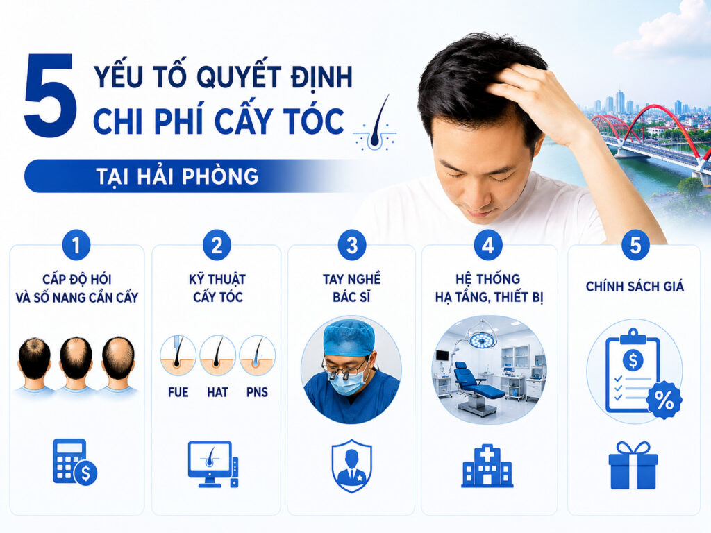 5 yếu tố quyết định chi phí cấy tóc tại Hải Phòng 