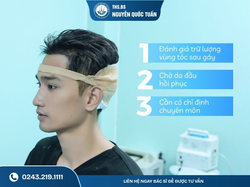 3 điều cần cân nhắc trước khi quyết định cấy tóc lần 2 