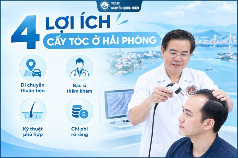 Tại sao nên cấy tóc ở Hải Phòng? 4 lợi ích đáng cân nhắc 