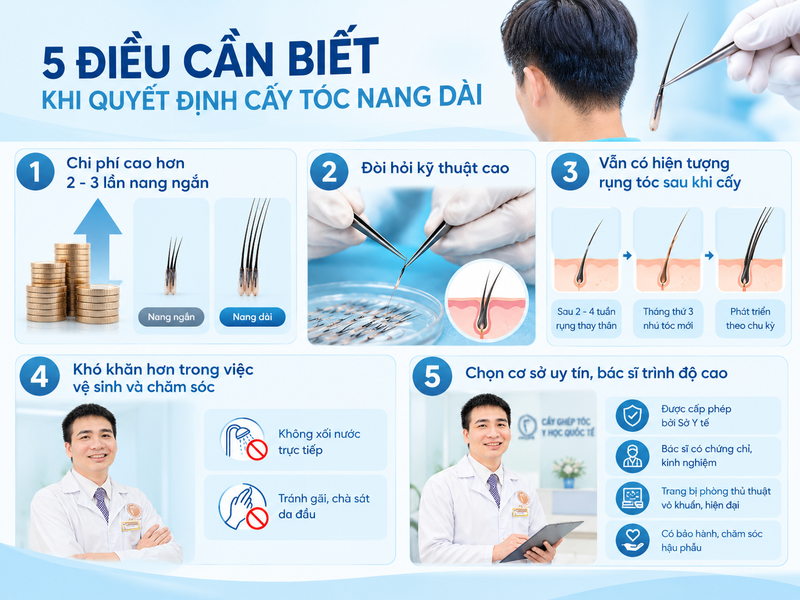 5 điều cần biết khi quyết định cấy tóc nang dài