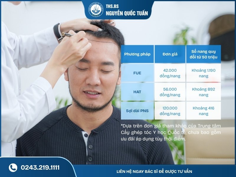 50 triệu cấy được bao nhiêu nang tóc 
