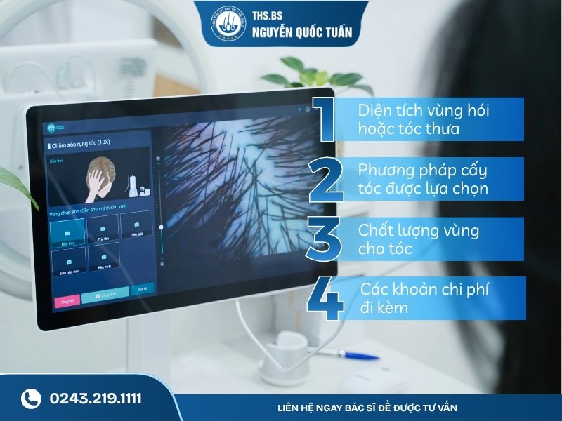 Những yếu tố quyết định chi phí cấy tóc với ngân sách 50 triệu 