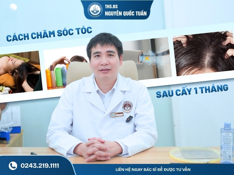  Cách chăm sóc tóc sau cấy 1 tháng để hỗ trợ tóc phát triển  