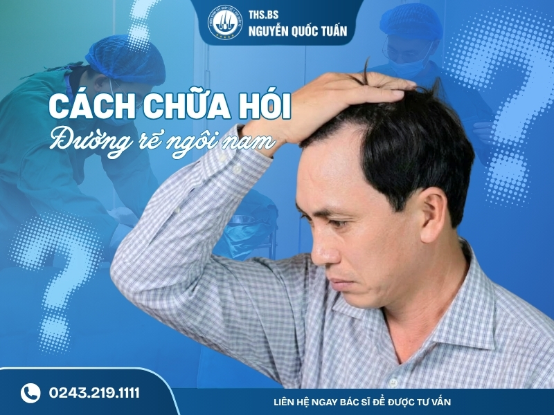 cách chữa hói đường rẽ ngôi