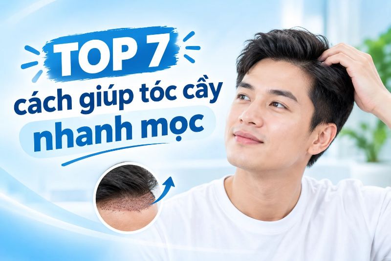 cách giúp tóc cấy nhanh mọc