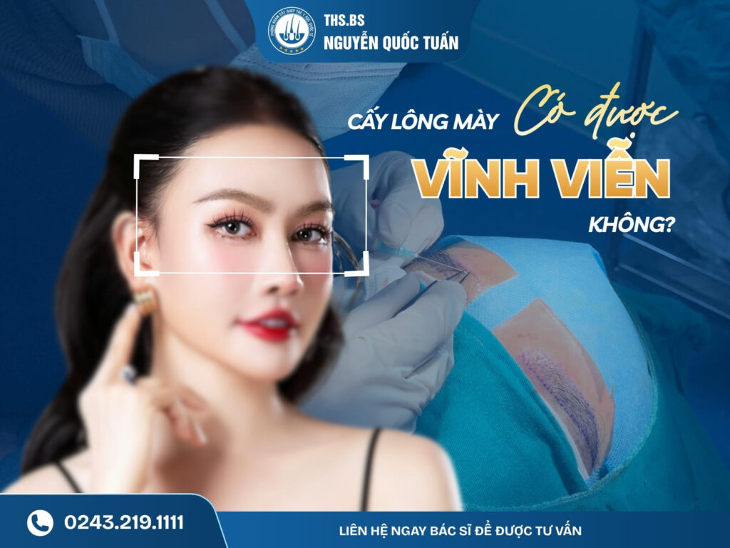 cấy lông mày có được vĩnh viễn không