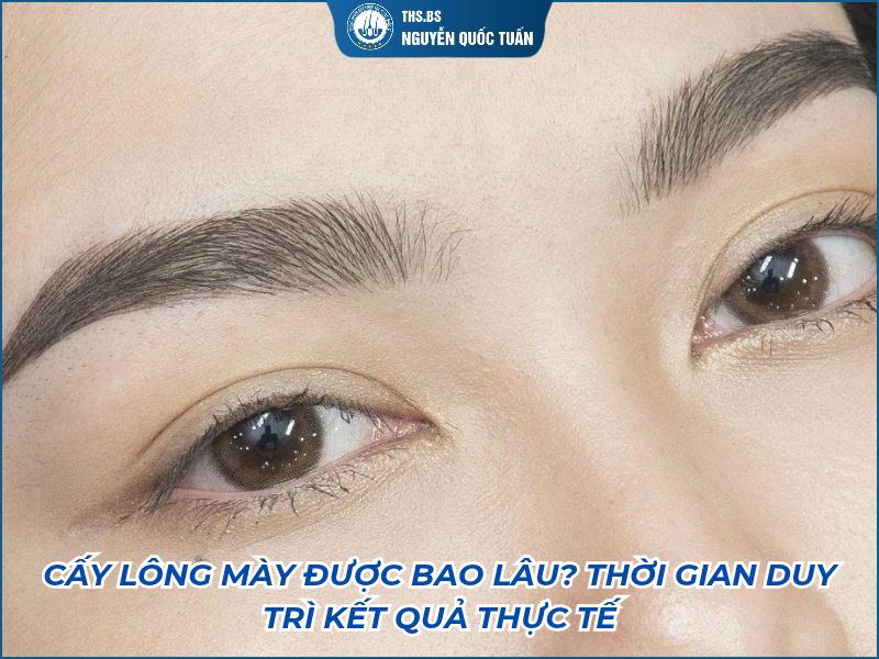 cấy lông mày được bao lâu