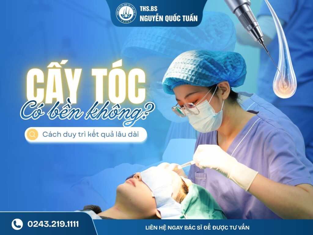 cấy tóc có bền không