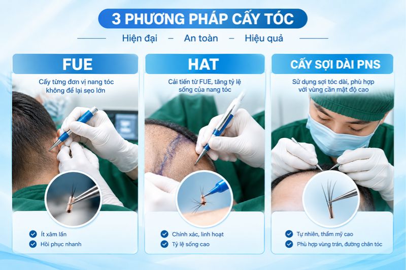 Cấy tóc nang dài có gì khác biệt so với cấy tóc thông thường? 