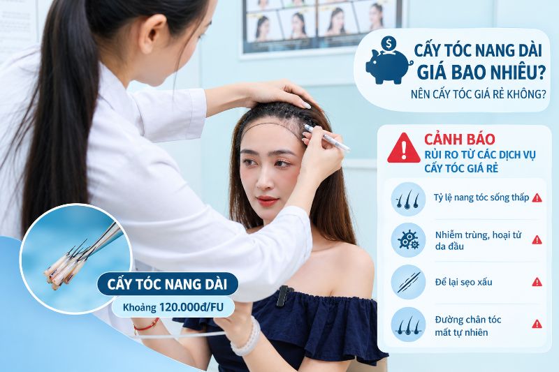 Cấy tóc nang dài giá bao nhiêu? Nên cấy tóc giá rẻ không