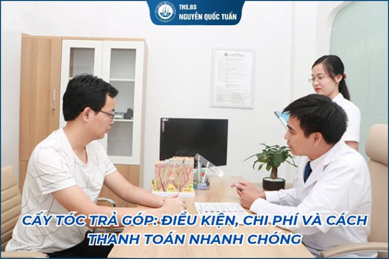 cấy tóc trả góp