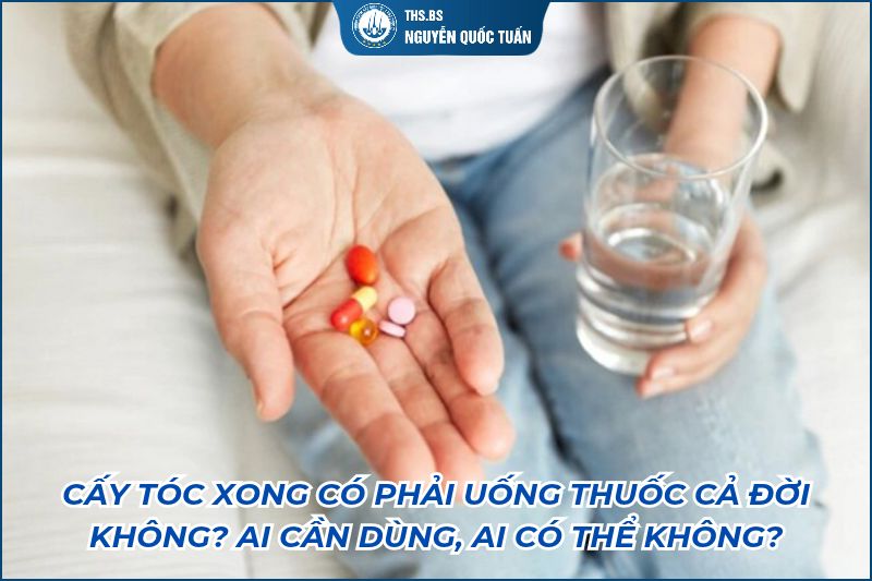 cấy tóc xong có phải uống thuốc không