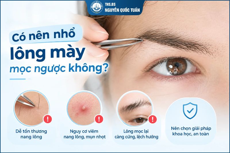 Có nên nhổ lông mày mọc ngược không