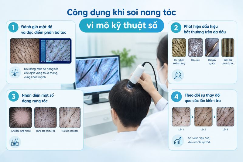 công dụng khi soi nang 
