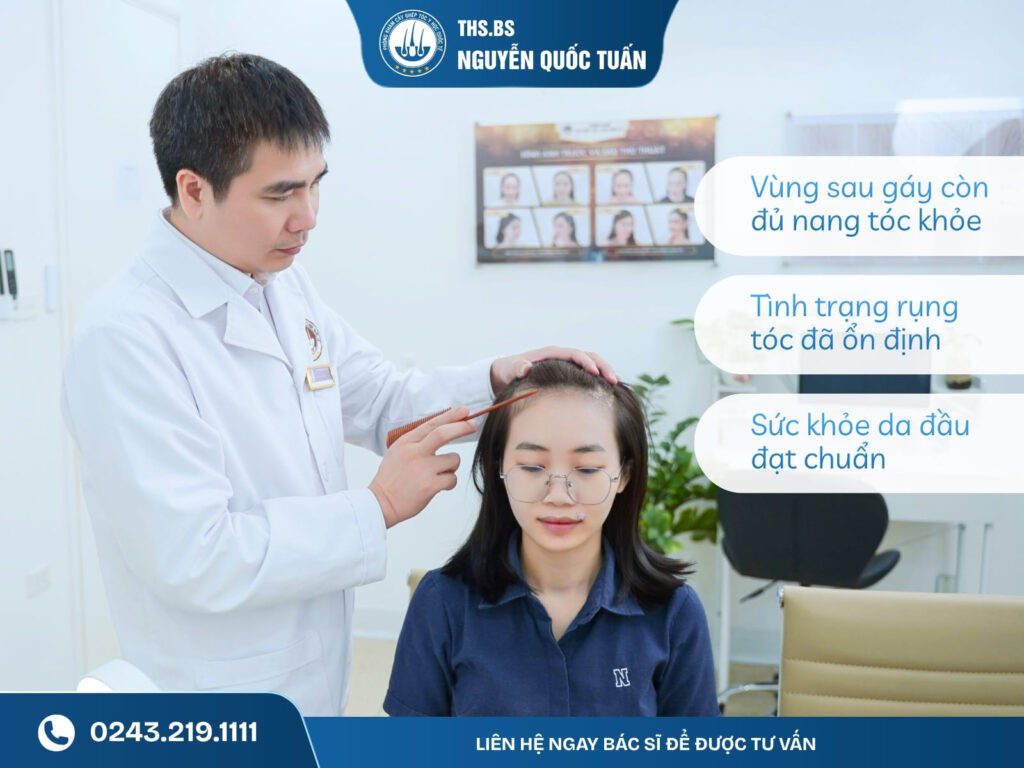 Điều kiện để người tóc mỏng yếu được cấy tóc 