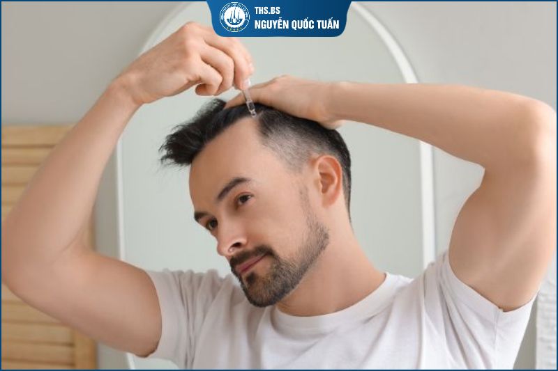  Khi nào nên dùng thuốc mọc tóc 