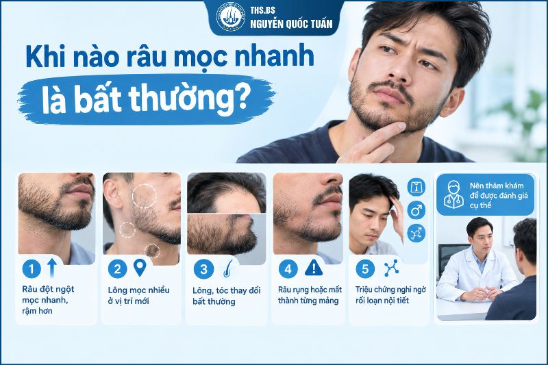 Khi nào râu mọc nhanh là bất thường