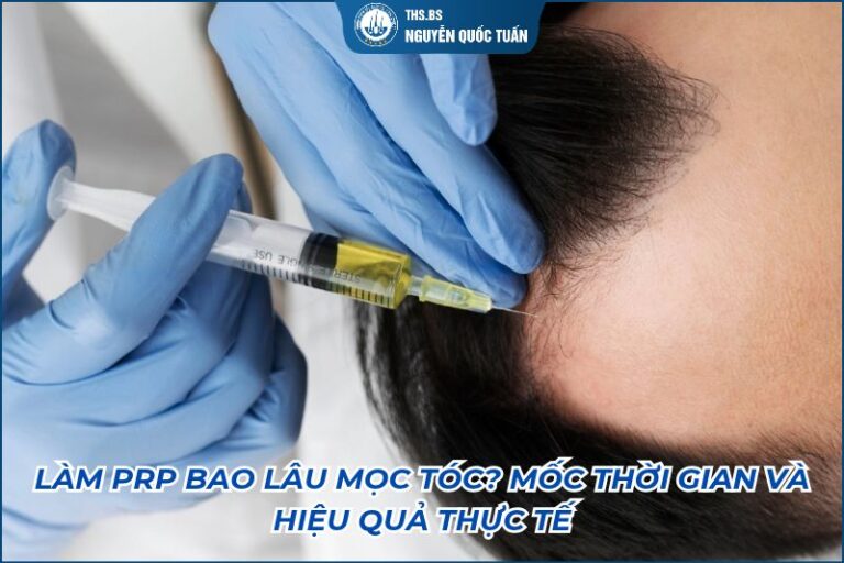 làm prp bao lâu mọc tóc
