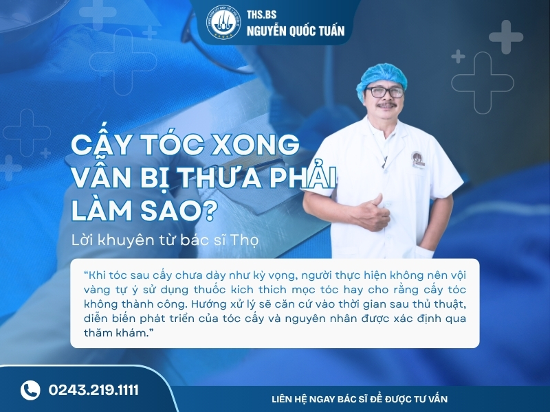 Lời khuyên giúp hạn chế tình trạng tóc thưa sau cấy