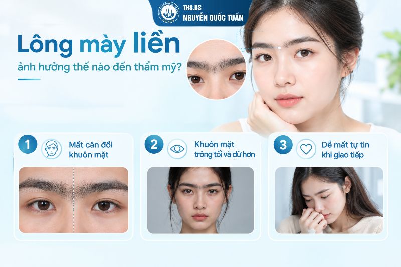 Lông mày liền ảnh hưởng thế nào đến thẩm mỹ 
