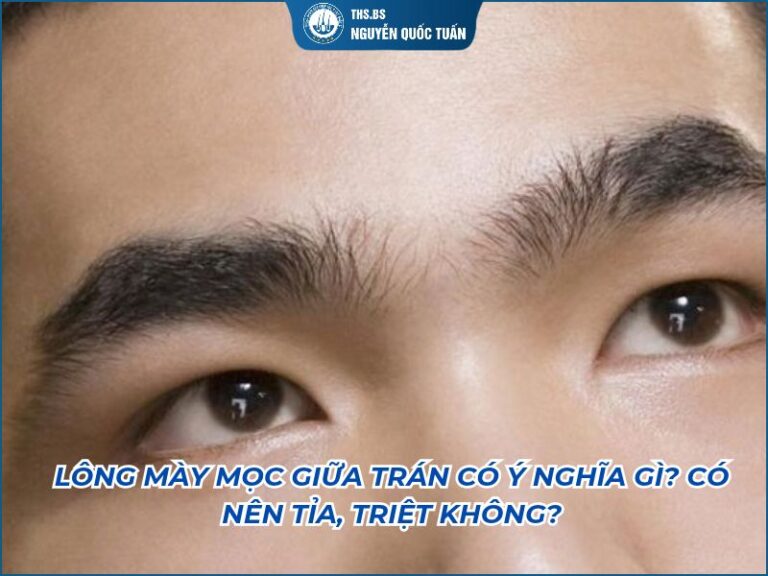lông mày mọc giữa trán có ý nghĩa gì